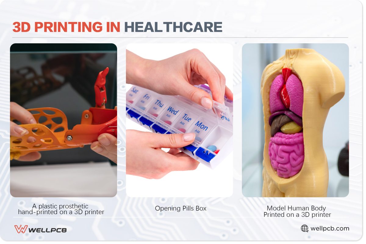 3D Printing in Healthcare