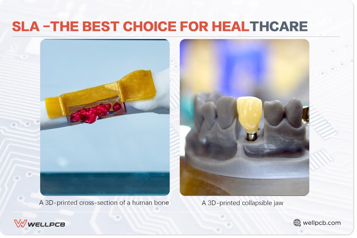 SLA -the Best Choice for Healthcare